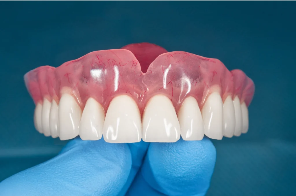 jenis janis gigi palsu