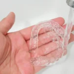 Cara Merawat Invisalign agar Awet
